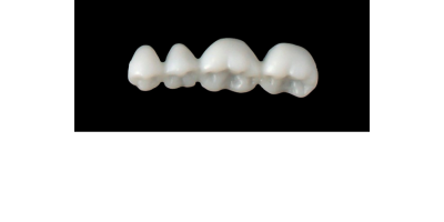 Cod.S3LOWER RIGHT : 15x  posterior solid (not hollow) wax bridges, SMALL, (44-47) , with precarved occlusion to Cod.S3UPPER RIGHT,and compatible to Cod.E3LOWER RIGHT (hollow), (44-47)
